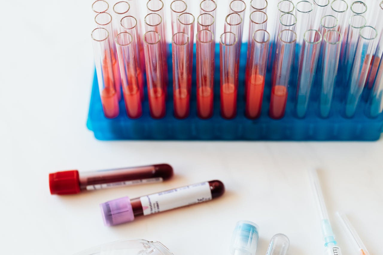 services-01 From above of plastic stand with test tubes of blood placed on white surface near vials of blood and syringe