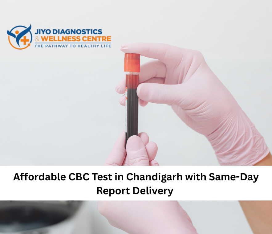 CBC Test in Chandigarh