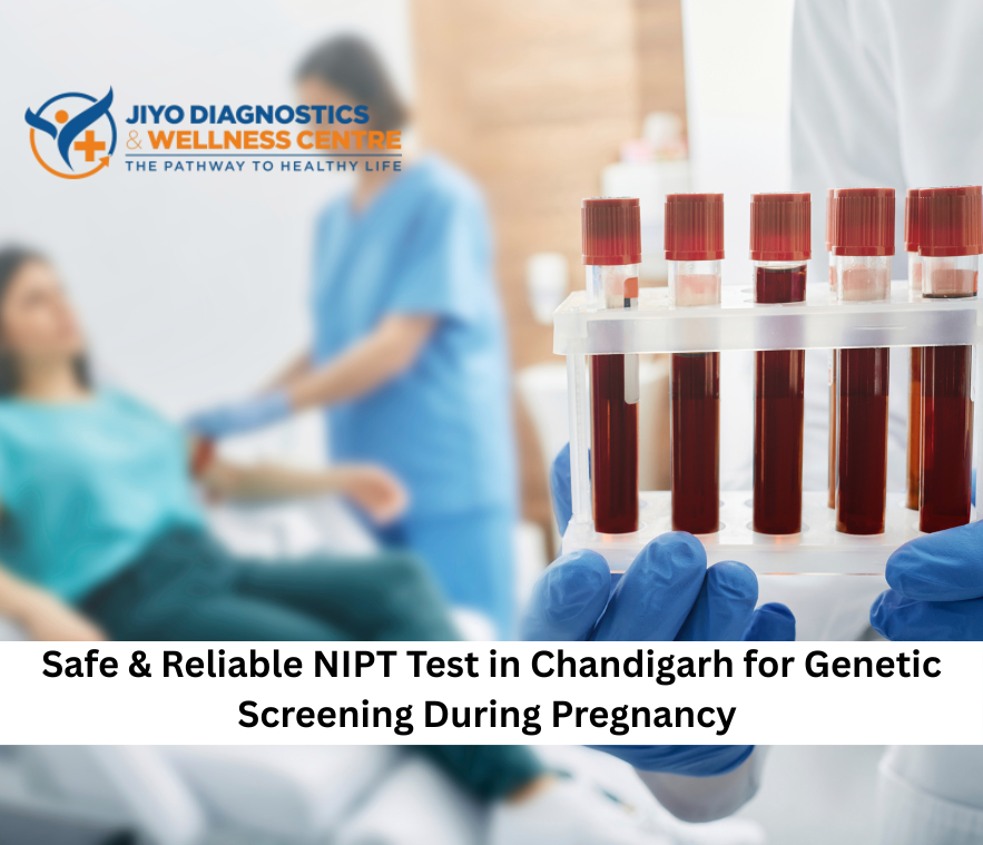 NIPT Test in Chandigarh