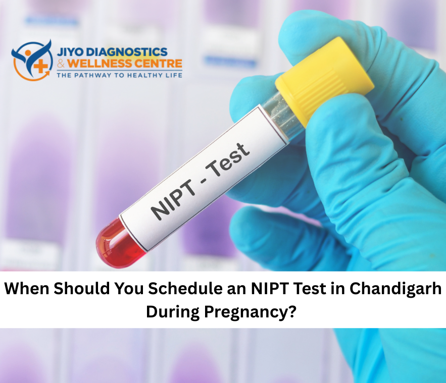 Jiyo Labs Chandigarh NIPT Tests in Chandigarh